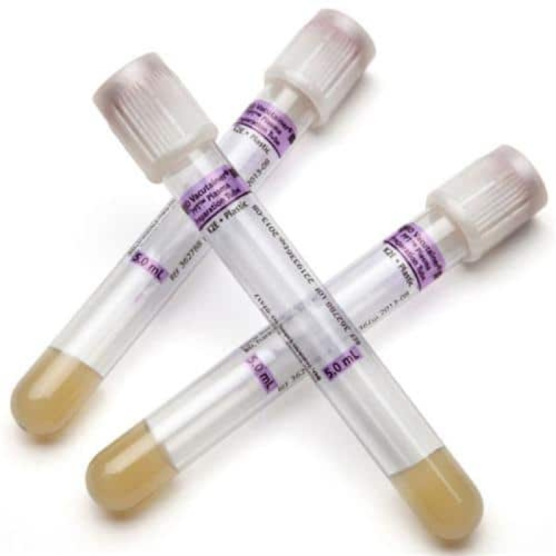 Blood Collection Tubes - Image 5